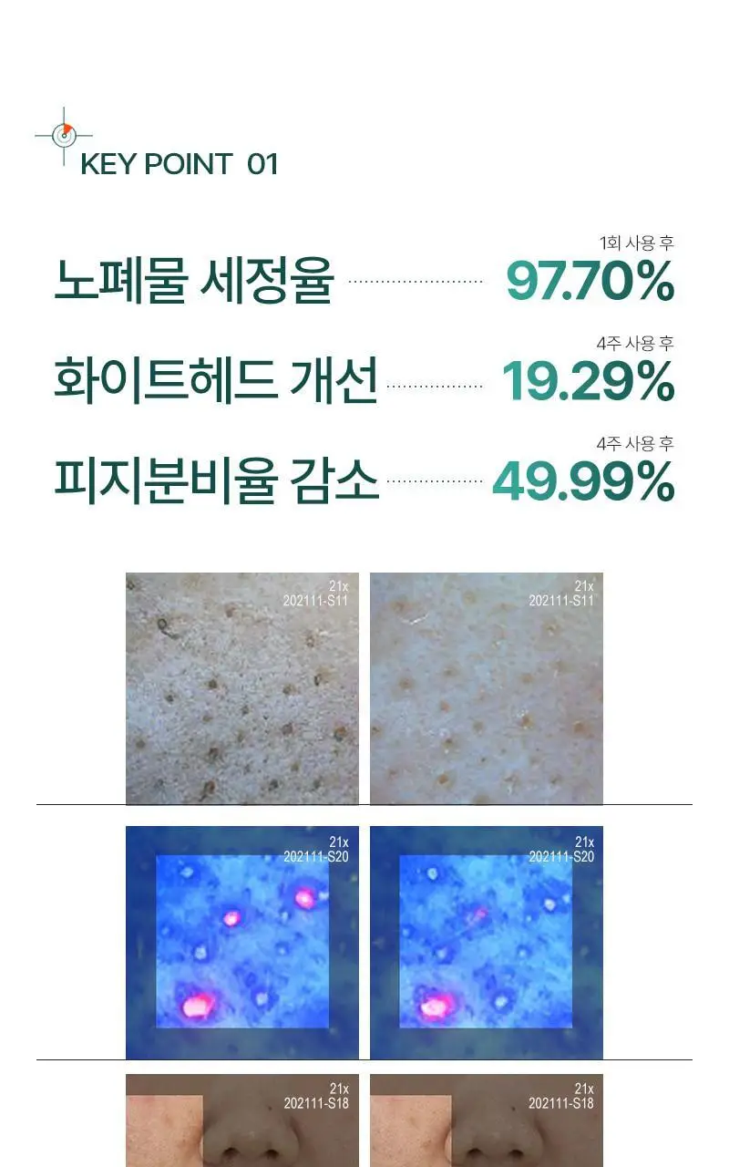 [피지/모공케어] 피캄 언더포어 바테카 폼 클렌징 150ml 상세페이지 19